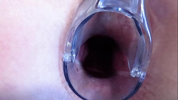 Stretching the anal and vagina with a gynecological speculum. MILF with a big butt and a gaping asshole and a gaping pussy.